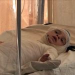В помощи нуждается девочка из Житомирской области, которая получила 45% ожогов тела. ВИДЕО