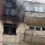 В Житомирской области на пожаре едва не погибла 73-летняя бабушка