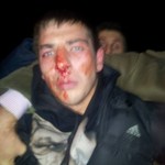 Милиция выяснила кто избил организаторов Евромайдана в Житомире. ФОТО