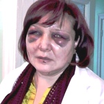 В Житомире зверски избиты посетители кафе: подозревают охранника и активиста АТО. ВИДЕО
