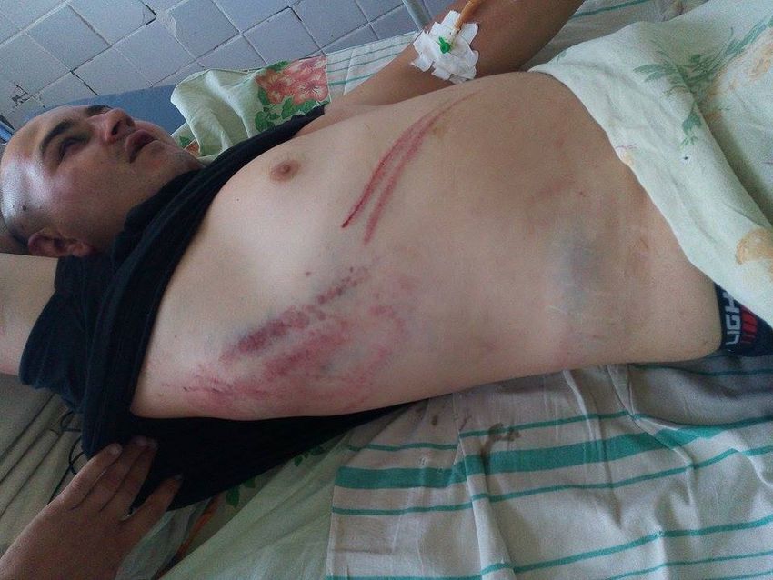 Кримінал: Милиция задержала молодчиков, которые жестоко избили волонтера на Житомирщине