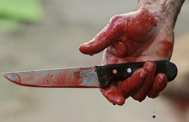 Толпа в Житомире едва не устроила самосуд над мужчиной, который зарезал на улице парня. ФОТО