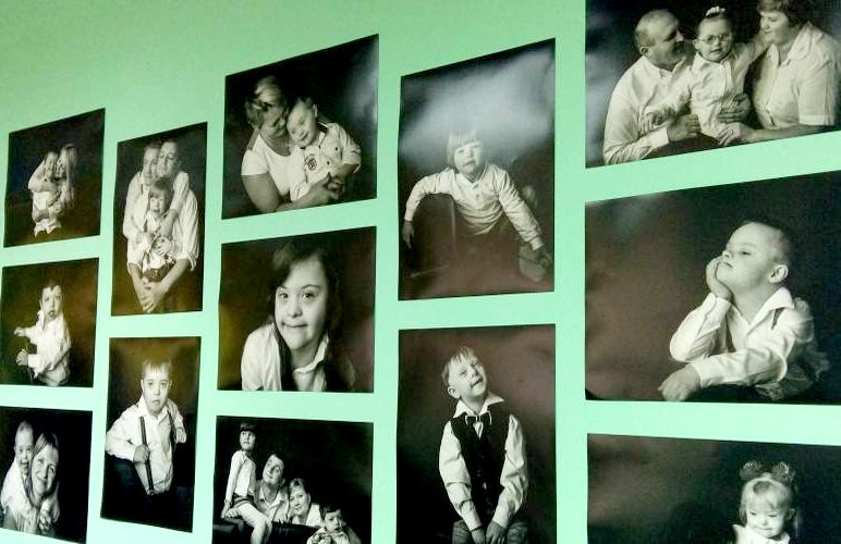 Международный день человека с синдромом Дауна в Житомире отметили фотовыставкой