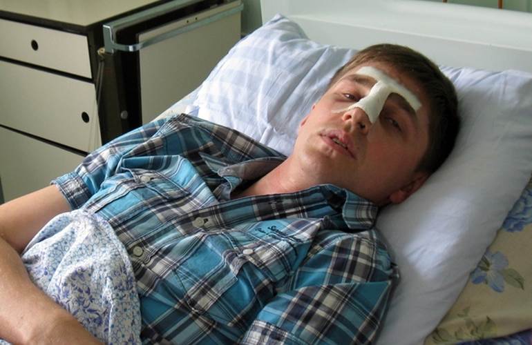 Неадекватный посетитель сломал нос заведующему реанимацией в Житомирской больнице