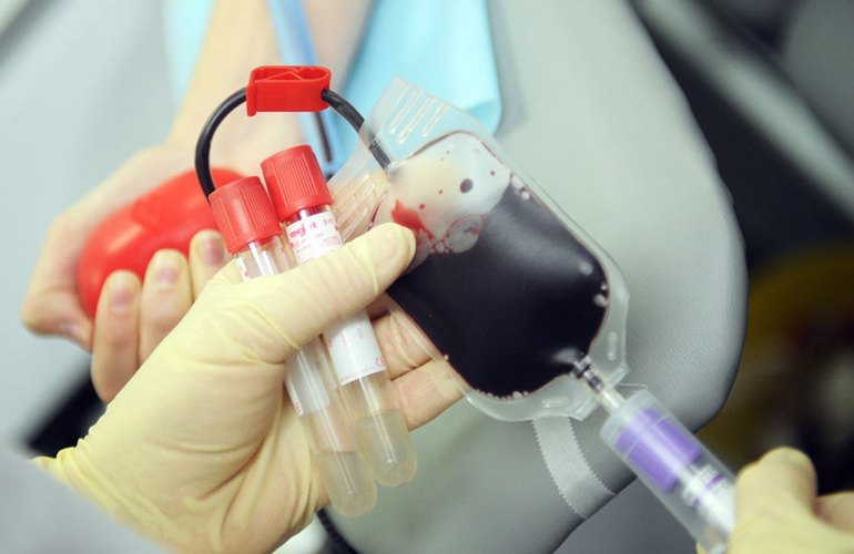 Критически не хватает крови и плазмы: житомирян призывают стать донорами