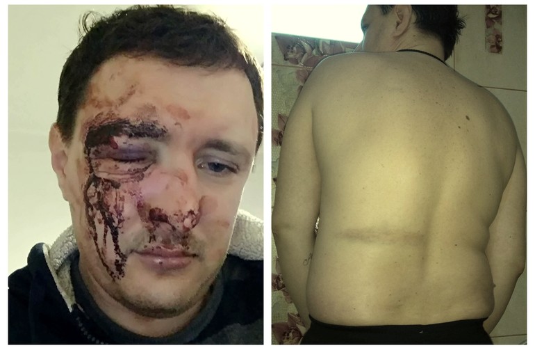 В Житомире патрульный полицейский жестоко избил мужчину возле магазина. Начато служебное расследование