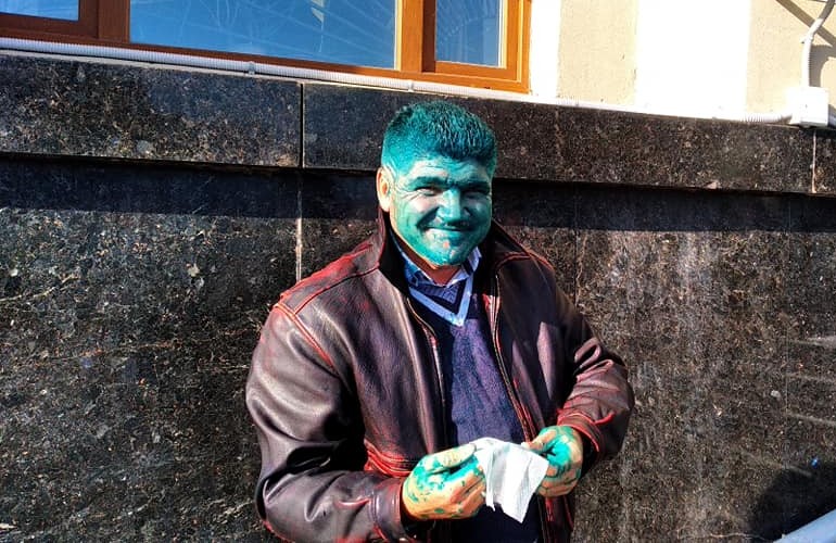 Противники создания «Громадської ради» в Житомире облили зеленкой общественного активиста. ФОТО