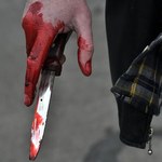 Кримінал: На улице в Коростене гопник с кухонным ножом напал на 25-летнюю девушку