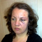 Кримінал: За избиение ребенка в Коростене будут судить жену экс-главы МЧС