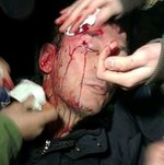 Общество: Участников автомайдана избил «Беркут»: пострадал Луценко. ВИДЕО