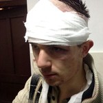 Происшествия: В Житомире продолжают безнаказанно избивать людей. ФОТО