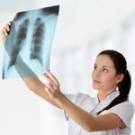 ​В прошлом году на Житомирщине обнаружили 853 новых случая заболевания туберкулезом