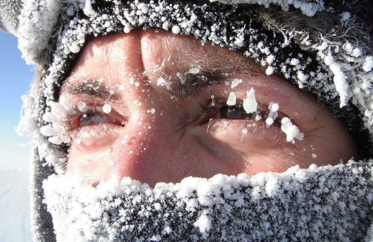 В Житомирскую область идет похолодание: советы, как не замерзнуть на улице