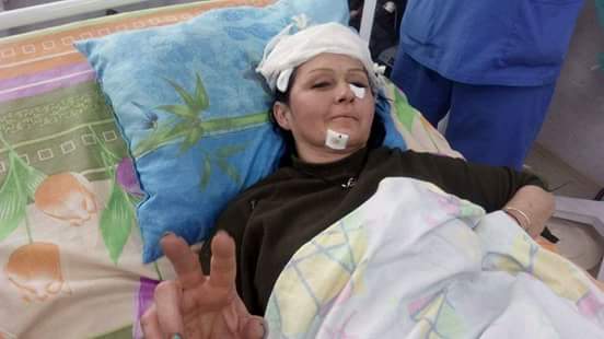 Волонтер Юлия Толмачева попала под снайперский огонь боевиков и была ранена в голову