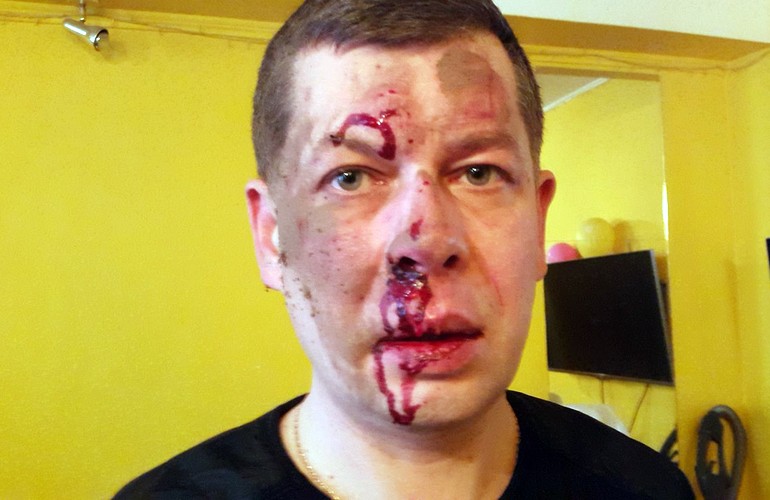 Бандитский Бердичев: неизвестные избили главного редактора интернет-издания Валерия Шелепу