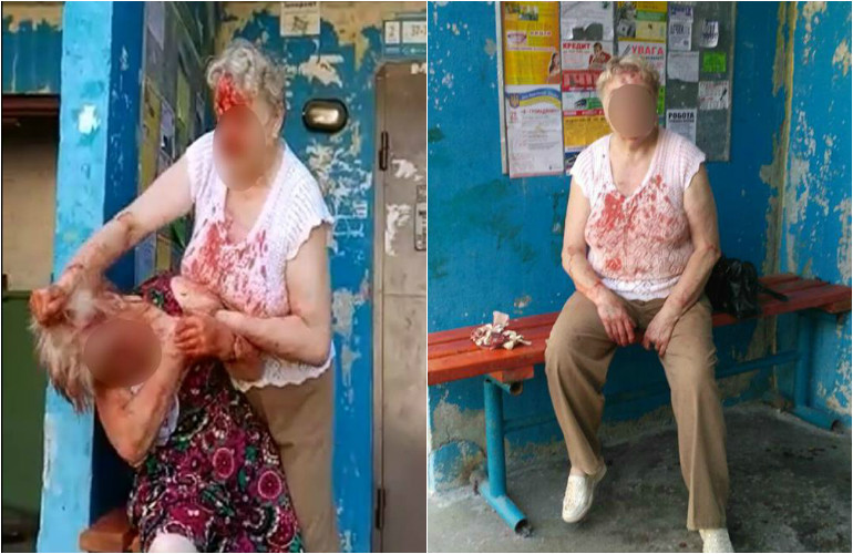 Две пенсионерки устроили кровавую драку в Житомире. ФОТО