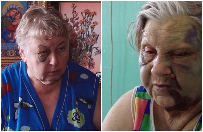 Драка пенсионерок в Житомире: стали известны детали кровавого побоища. ВИДЕО