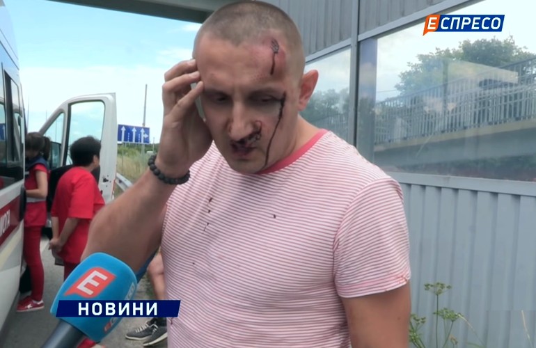 На трассе Житомир-Киев нападавший подрезал авто и кинулся с ножом на мужа своей бывшей жены. ВИДЕО