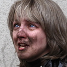В кровавом теракте в Минске пострадала украинка из Житомирской области