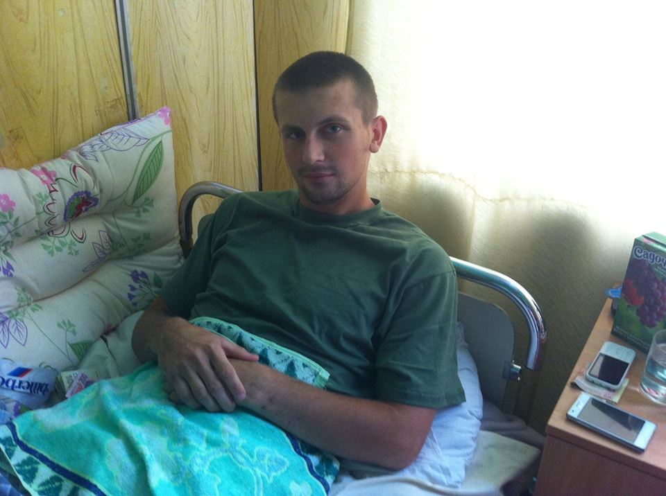 Житомирскому десантнику оторвало ногу, врачи борются за другую